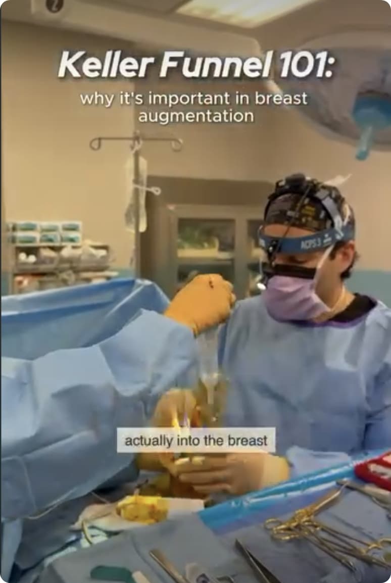 Keller Funnel 101: why its important in breast augmentation