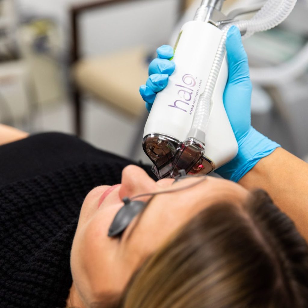 Patient having halo treatment preformed