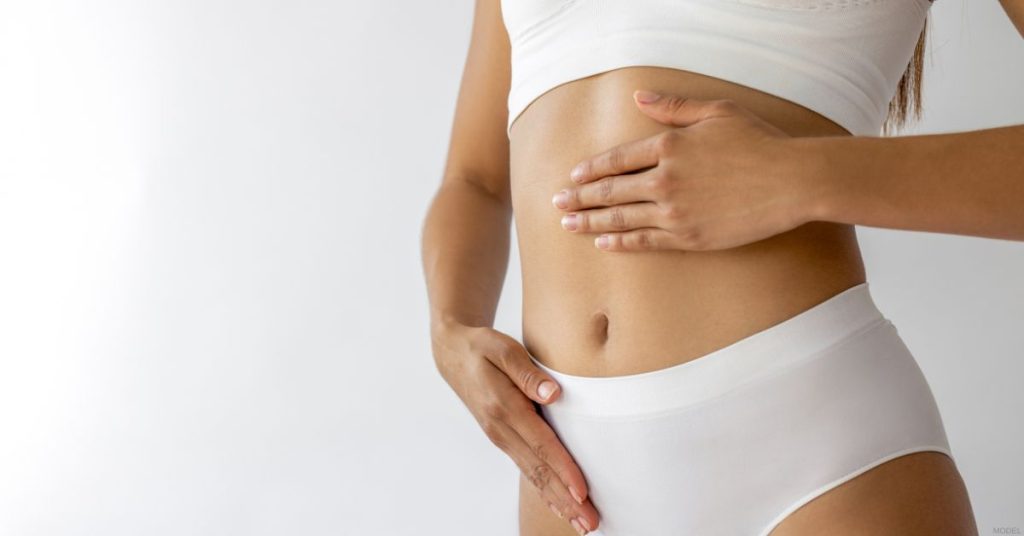 Woman showing off her liposuction results (model)