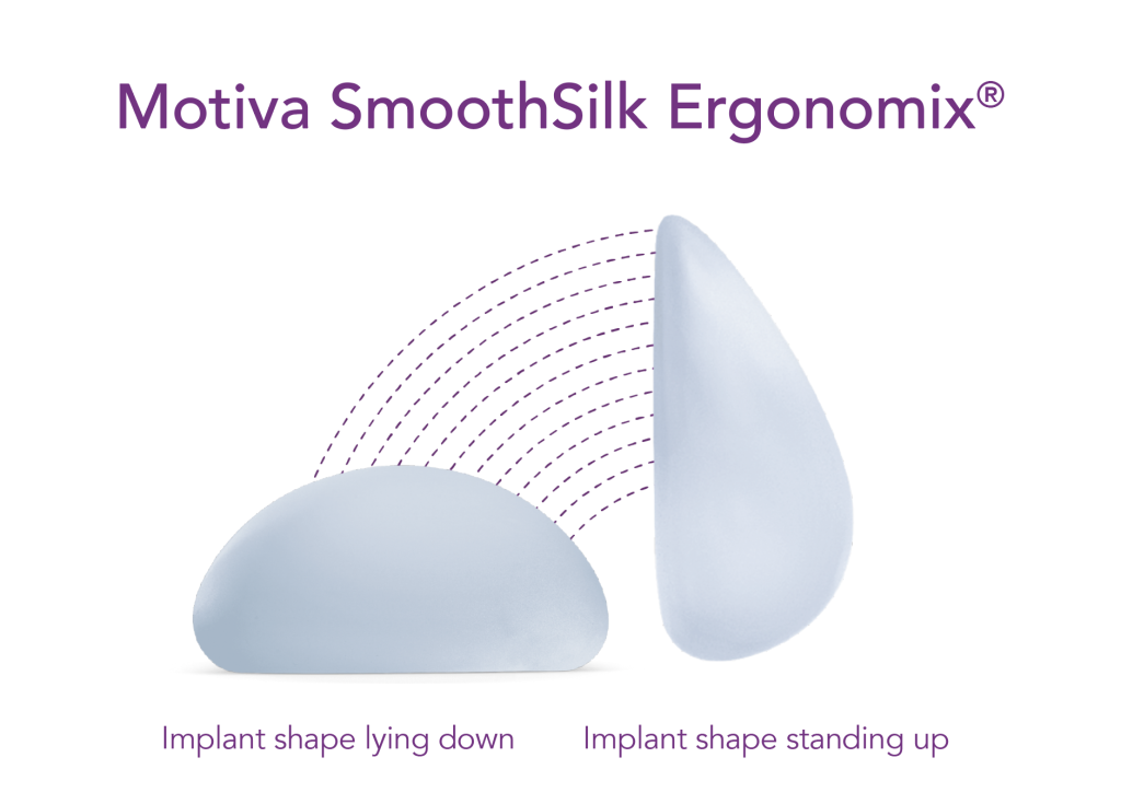 Motiva SmoothSilk Ergonomix breast implant illustration