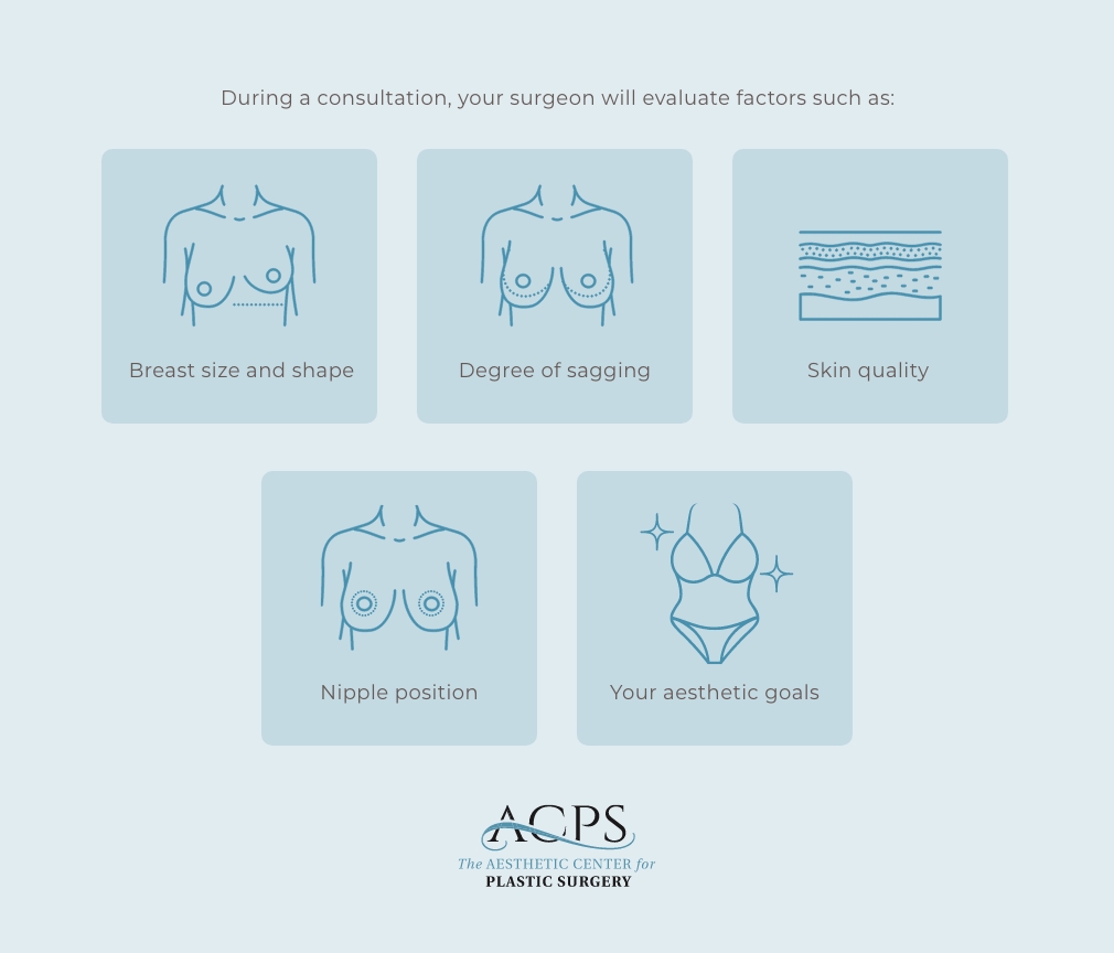Illustrated infographic by Aesthetic Center for Plastic Surgery showing factors evaluated during a breast surgery consultation, including breast size and shape, degree of sagging, skin quality, nipple position, and patient aesthetic goals.