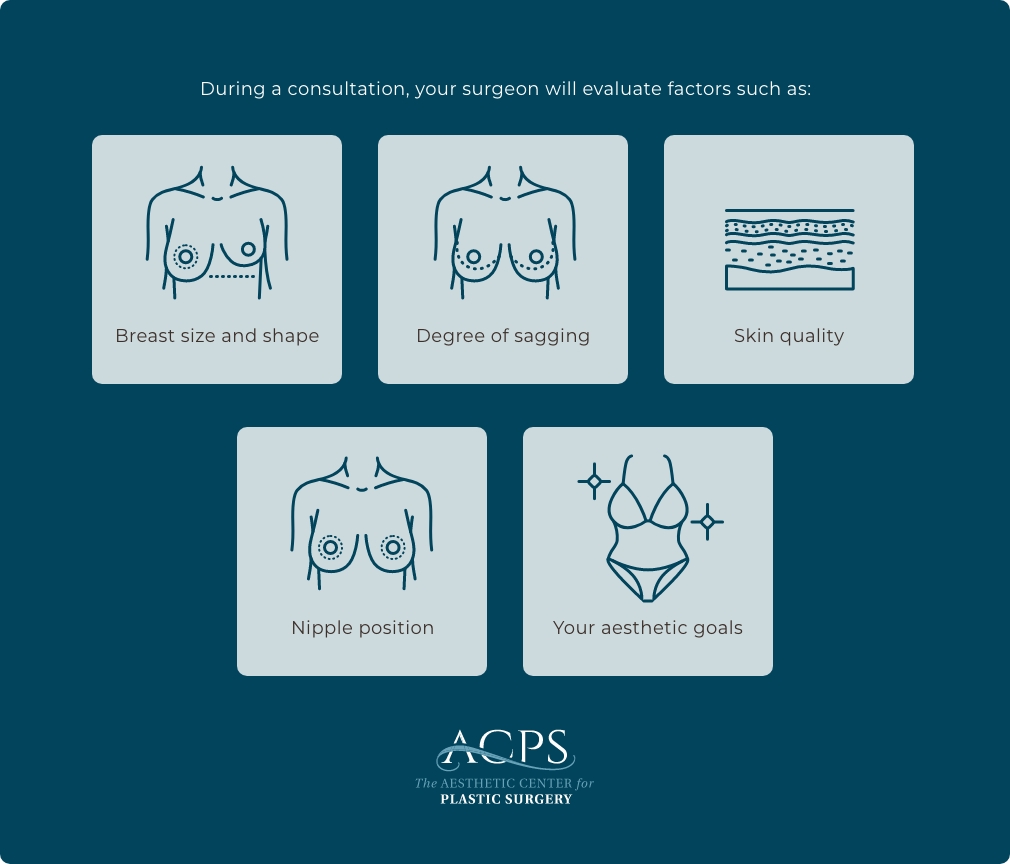 Illustrated infographic by Aesthetic Center for Plastic Surgery showing factors evaluated during a breast surgery consultation.