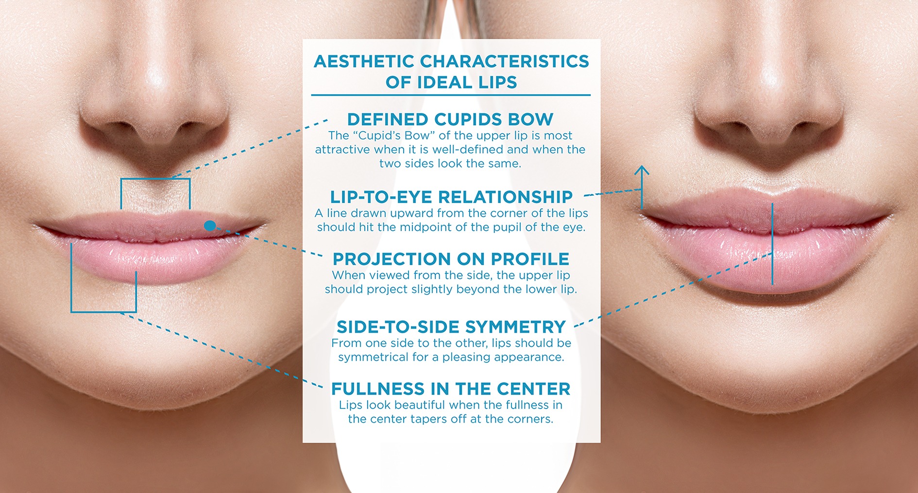 lips_structure-and-character-of-the-optimal-lip-2
