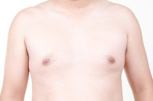 Choosing The Best Gynecomastia (Male Breast Reduction) Surgeon | Houston